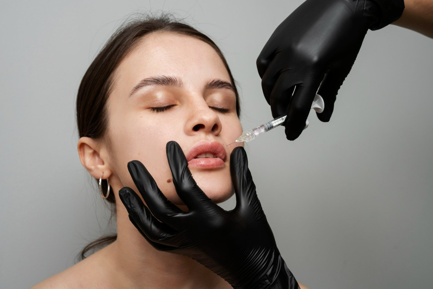 Can Lip Fillers Be Dissolved